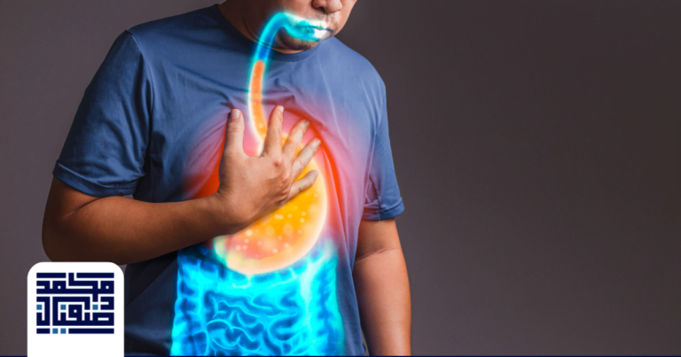 ارتجاع المرئ الدليل الشامل