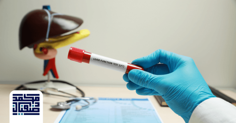 اسم تحليل مرض ويلسون