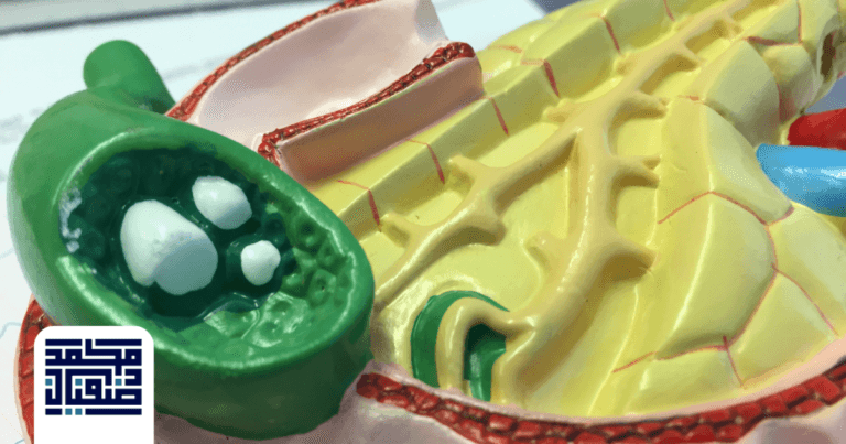 انسداد القناة المرارية