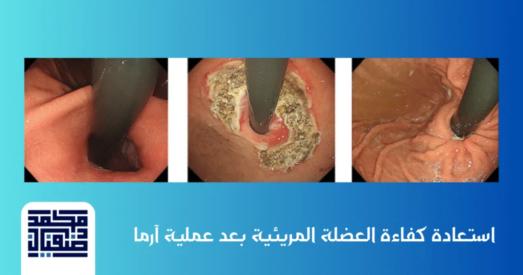 تقنية ارما تميز دكتور محمد صفيان بإجرائها