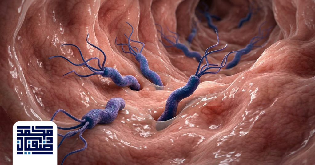 جرثومة المعدة: الأعراض، الأسباب وأحدث طرق العلاج