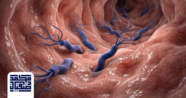جرثومة المعدة: الأعراض، الأسباب وأحدث طرق العلاج